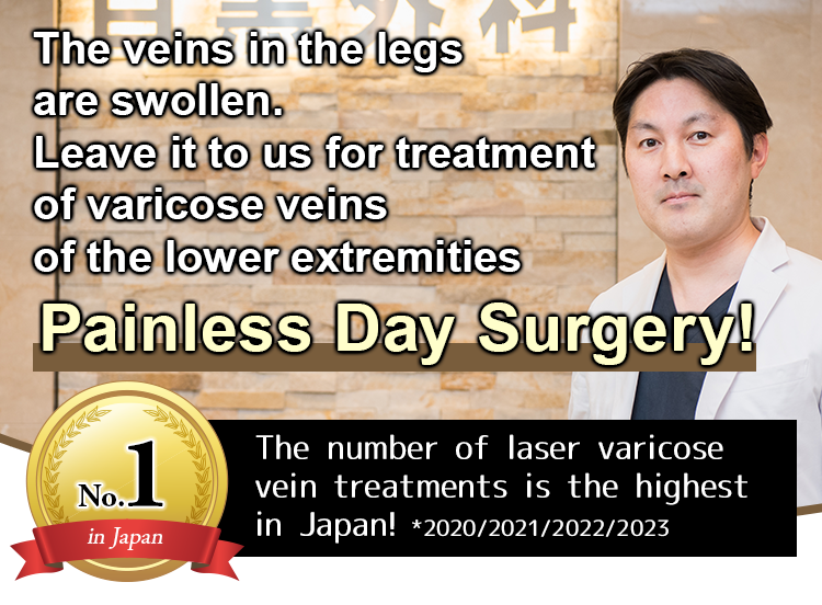 The veins in the legs are swollen. Leave it to us for treatment of varicose veins of the lower extremities