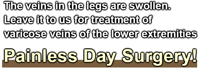 The veins in the legs are swollen. Leave it to us for treatment of varicose veins of the lower extremities